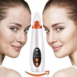 "GlowSkin™ Portable Blackhead Remover"